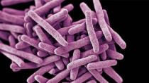 Μυστηριώδες μικρόβιο εξαπλώνεται στον κόσμο