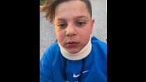 Aστυνομικός χτύπησε 11χρονο αγόρι στη μέση του δρόμου