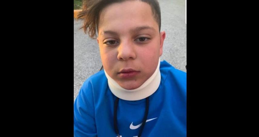 Aστυνομικός χτύπησε 11χρονο αγόρι στη μέση του δρόμου