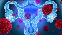 Ηράκλειο: Επιστημονική εκδήλωση εναν καρκίνο που απειλεί τις γυναίκες