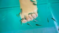 20χρονη έχασε όλα τα νύχια των ποδιών της μετά από σπα με ψάρια