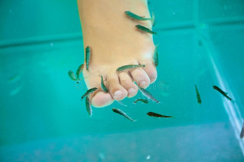 20χρονη έχασε όλα τα νύχια των ποδιών της μετά από σπα με ψάρια