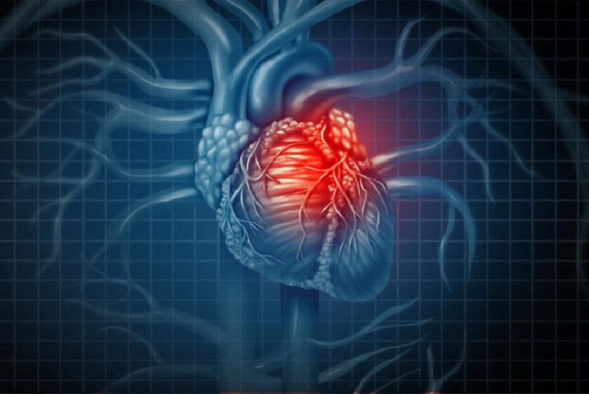 Καρδιακή προσβολή – Πρώτες βοήθειες: Τρία πράγματα που πρέπει να κάνετε εκείνη την στιγμή