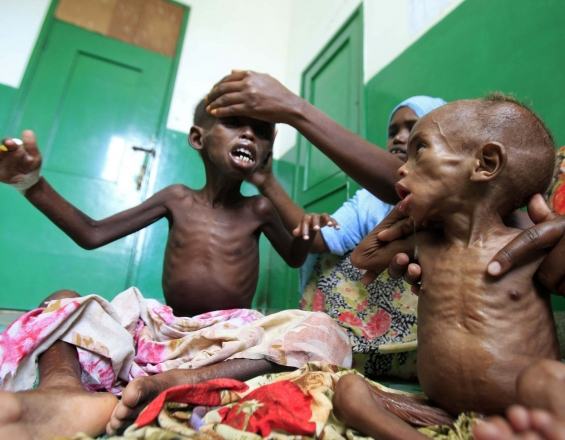 Αφρική: Ένα στα τρία παιδιά πεθαίνει από πείνα